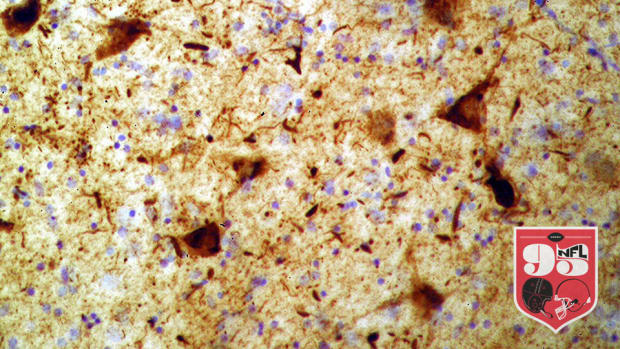 tau-protein-9601.jpg